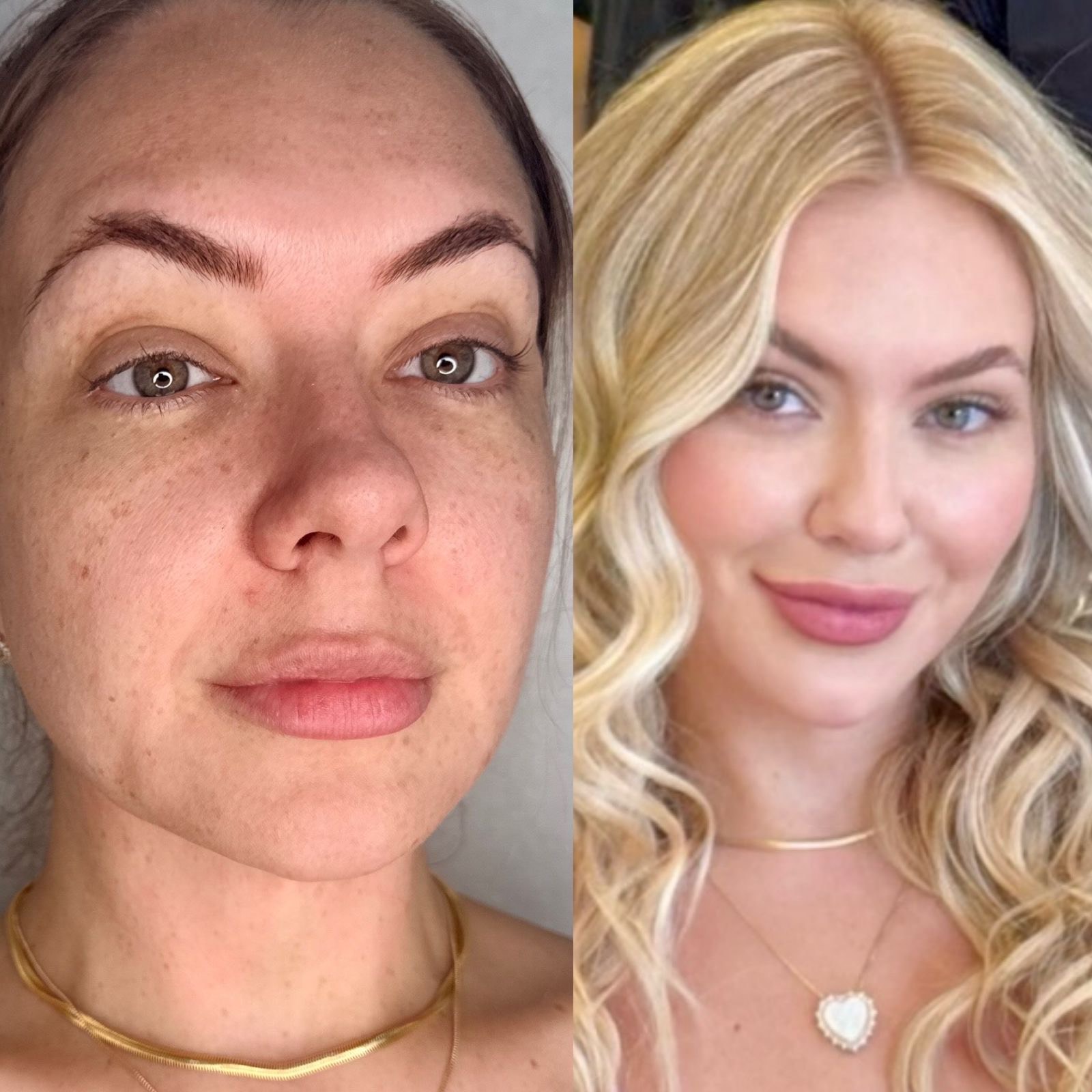 Antes e depois