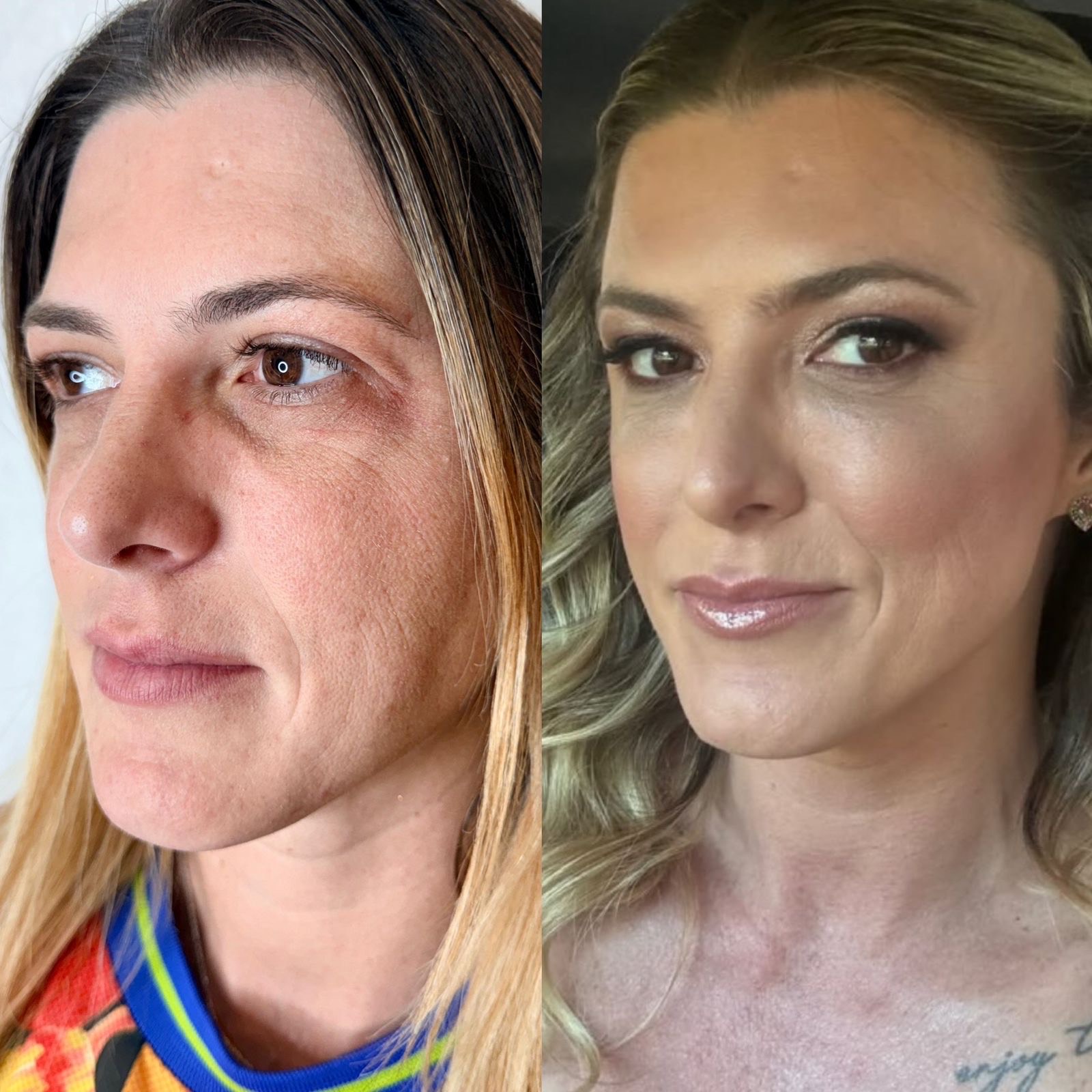 Antes e depois