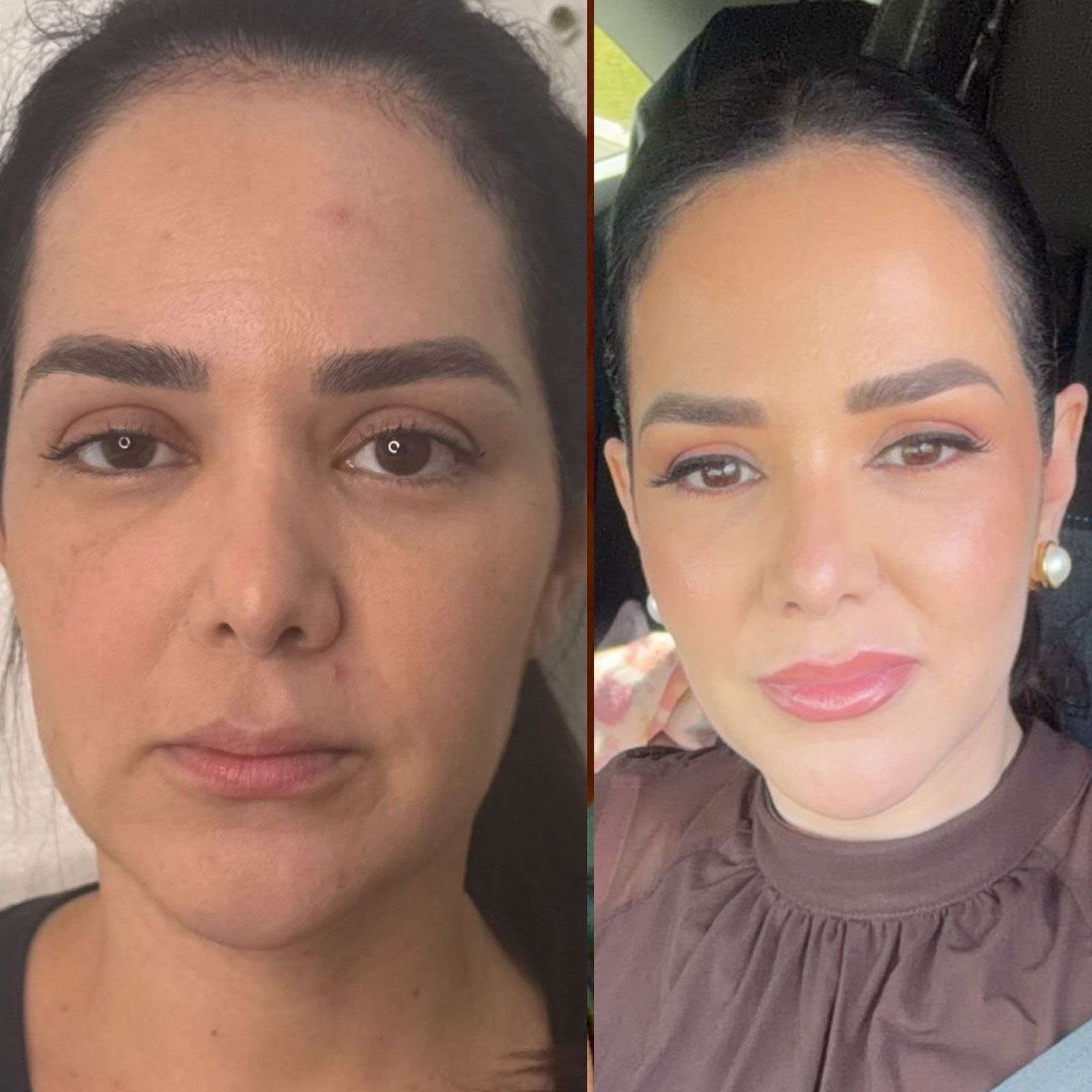 Antes e depois