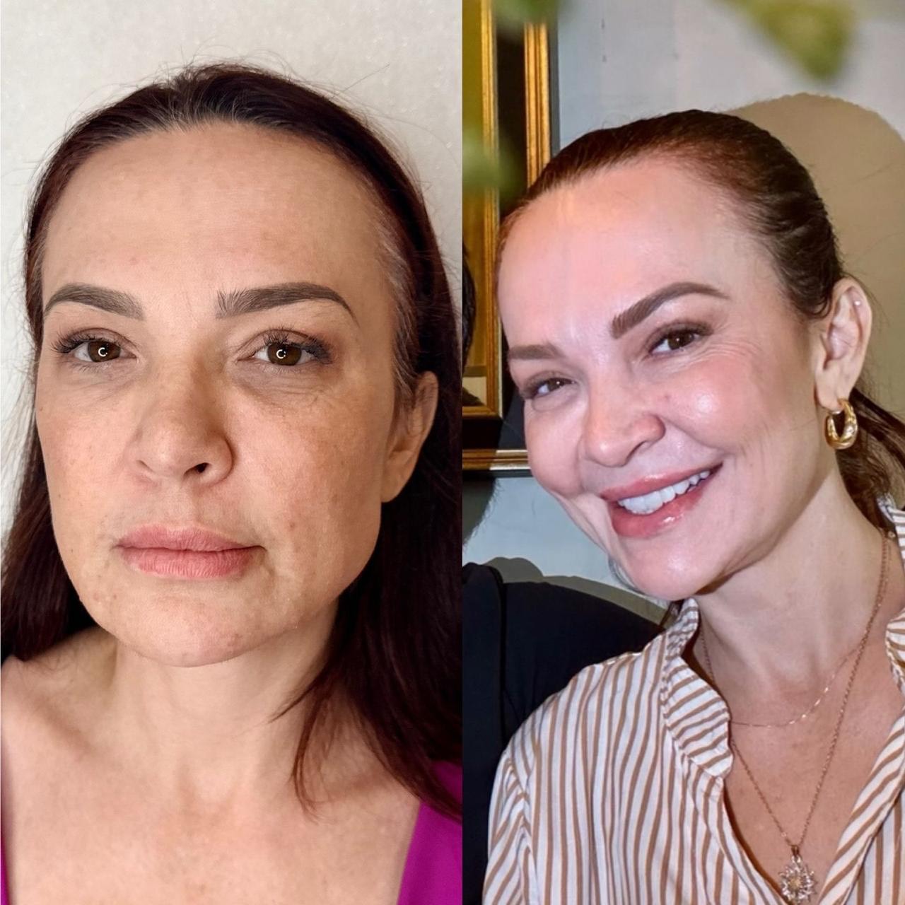 Antes e depois